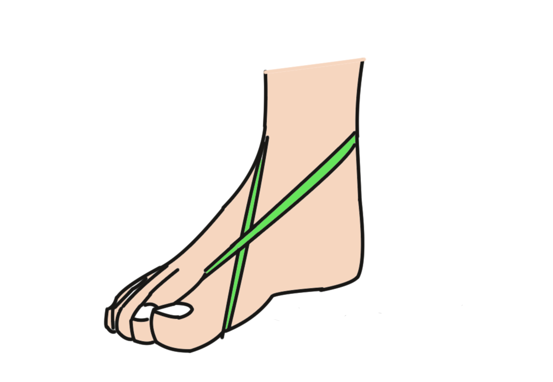 脚輪ゴム 新しい風